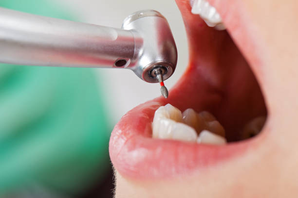 Best Emergency Treatment for Oral Infections in Columbus, TX